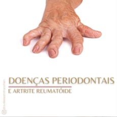 Doenças periodontais e Artrite Reumatoide Doenças periodontais e Artrite Reumatoide
