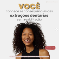 Você conhece as consequências das extrações dentárias sem reabilitação?