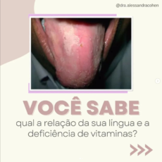 Você sabe qual a relação da sua língua e a deficiência de vitaminas?